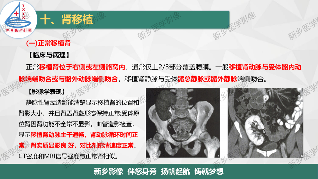 影像PPT - 【PPT】输尿管及膀胱肿瘤分期及肾脏外伤分级-21