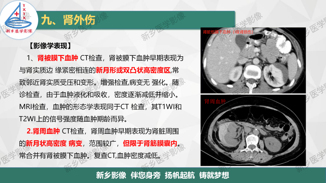 影像PPT - 【PPT】输尿管及膀胱肿瘤分期及肾脏外伤分级-19