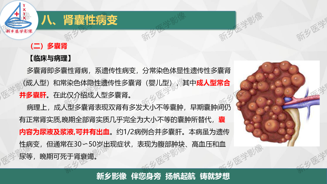 影像PPT - 【PPT】输尿管及膀胱肿瘤分期及肾脏外伤分级-15