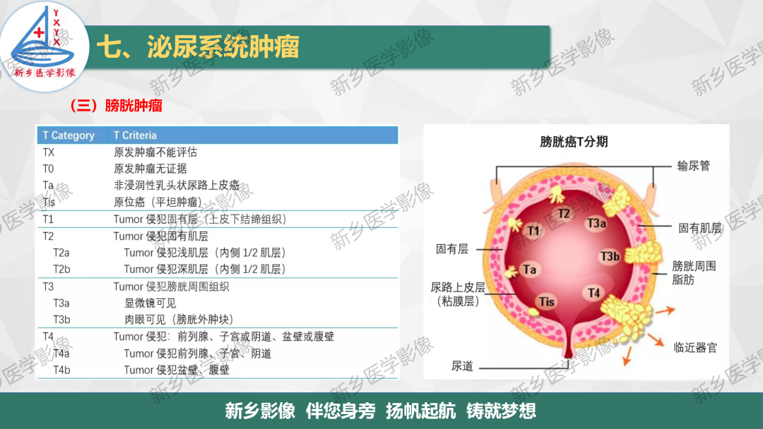 影像PPT - 【PPT】输尿管及膀胱肿瘤分期及肾脏外伤分级-10