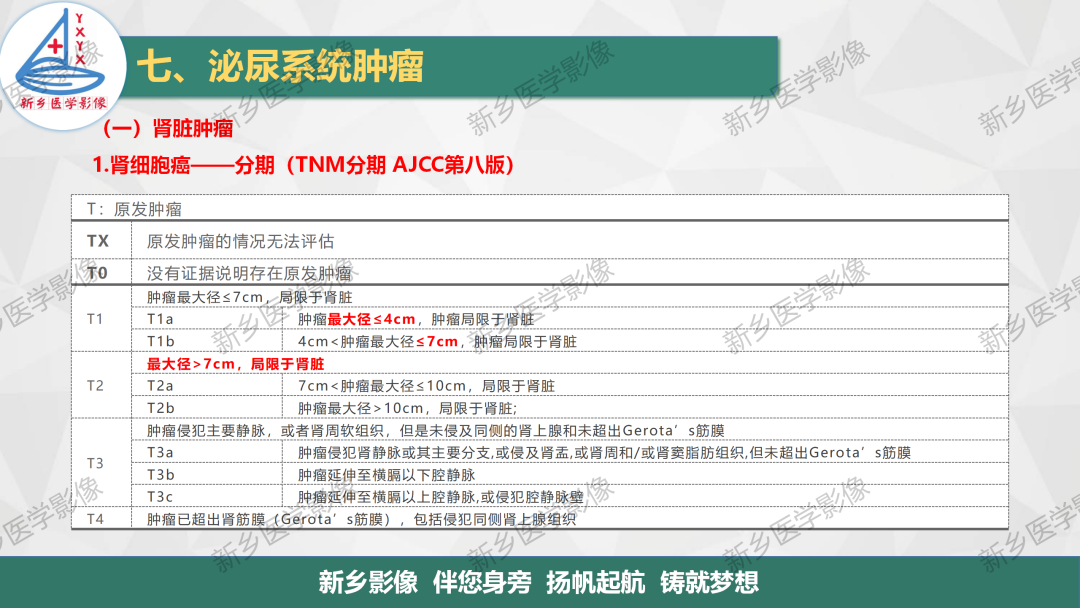 影像PPT - 【PPT】肾脏肿瘤分期 并与肾脏血管平滑肌脂肪瘤鉴别要点-7