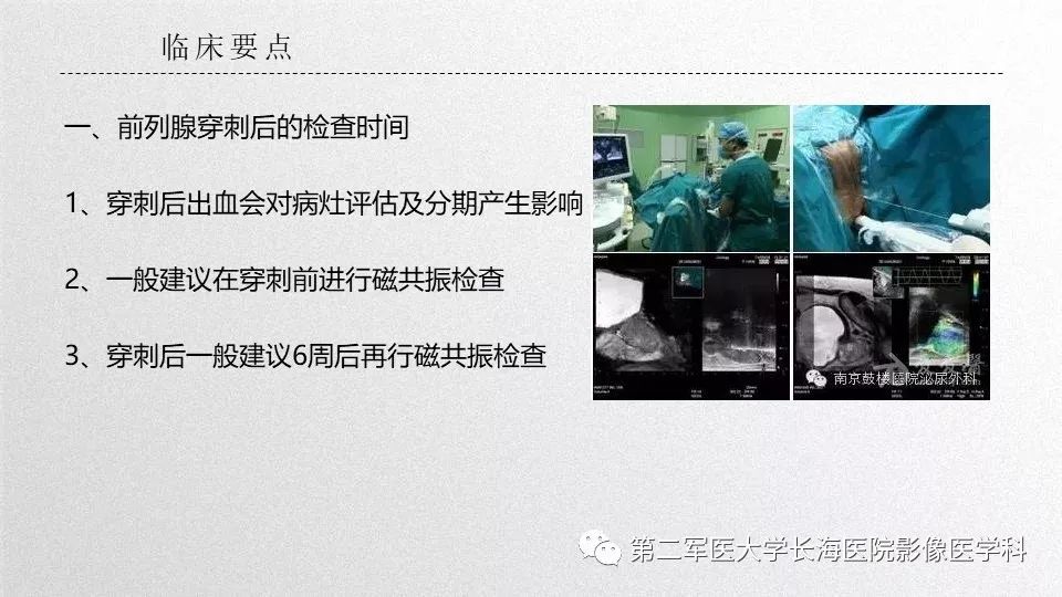 影像PPT - 【PPT】前列腺影像、报告及数据系统临床应用-1 影像PPT - 【PPT】前列腺影像、报告及数据系统临床应用-1