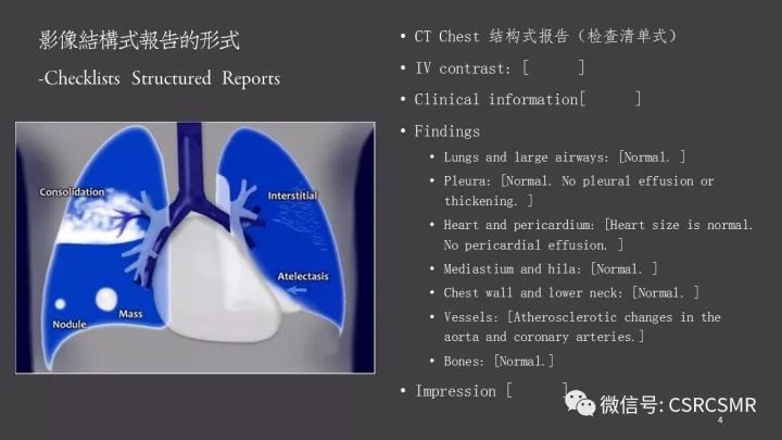 影像PPT - 【PPT】肩关节MRI的结构式评估-4