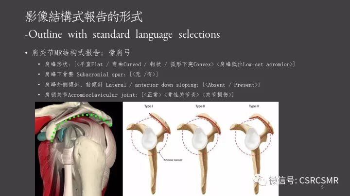 影像PPT - 【PPT】肩关节MRI的结构式评估-5