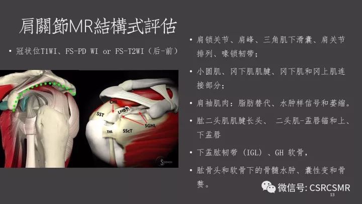影像PPT - 【PPT】肩关节MRI的结构式评估-13