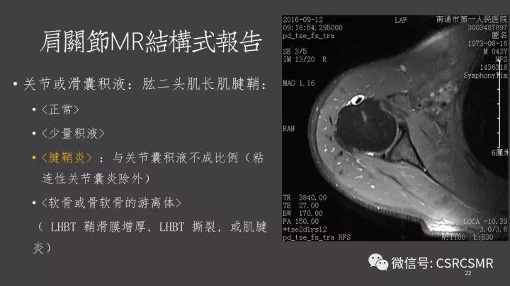 影像PPT - 【PPT】肩关节MRI的结构式评估-22