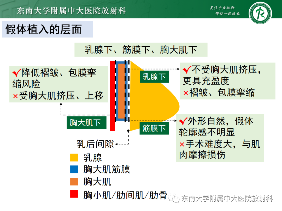影像PPT - 【PPT】隆乳术后假体破裂的MRI表现-15