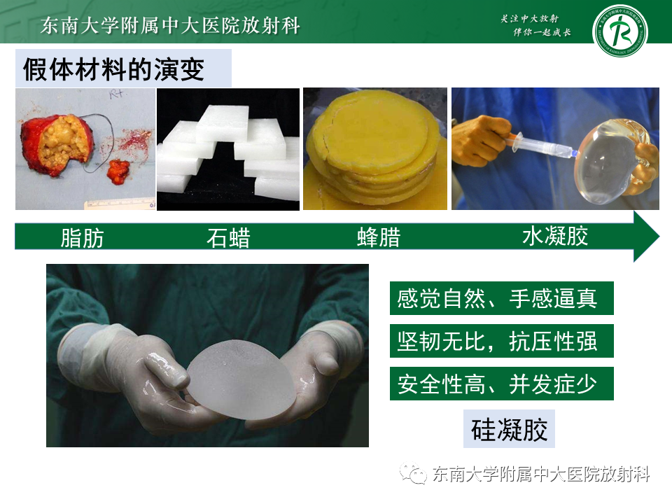 影像PPT - 【PPT】隆乳术后假体破裂的MRI表现-14