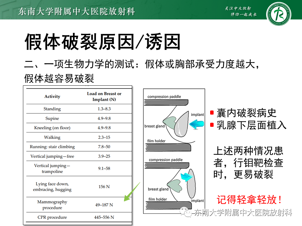 影像PPT - 【PPT】隆乳术后假体破裂的MRI表现-23