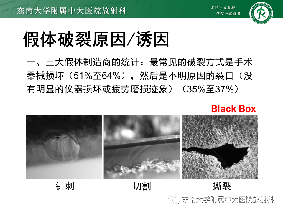 影像PPT - 【PPT】隆乳术后假体破裂的MRI表现-22