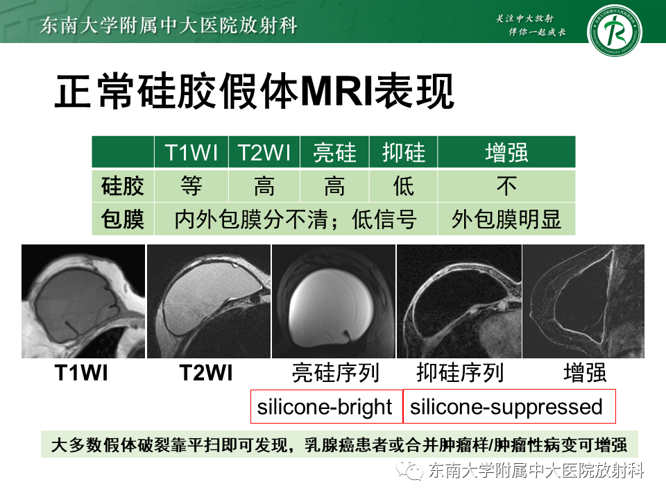 影像PPT - 【PPT】隆乳术后假体破裂的MRI表现-17