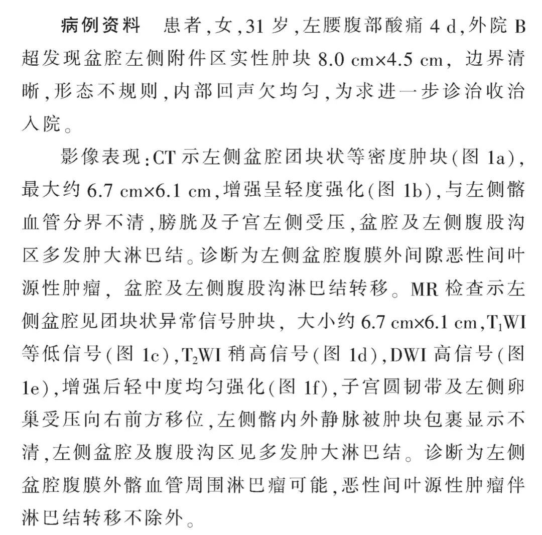 影像PPT - 【病例】盆腔腹膜外肿块—淋巴瘤1例影像诊断思维-3