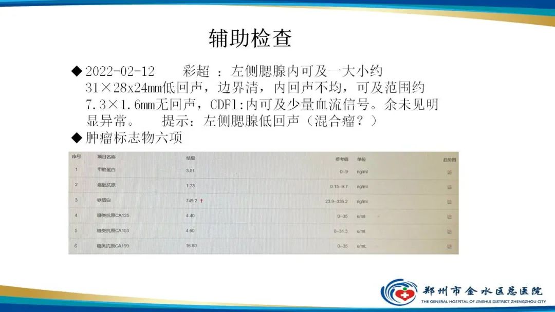 影像PPT - 【病例】腮腺多形性腺瘤1例CT影像-3
