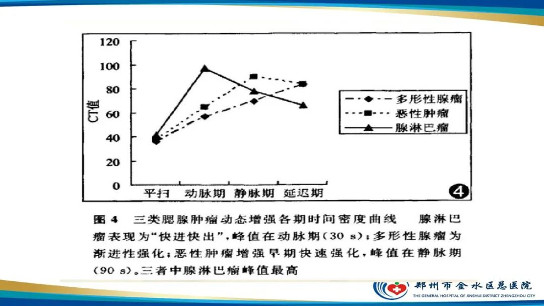 影像PPT - 【病例】腮腺多形性腺瘤1例CT影像-30