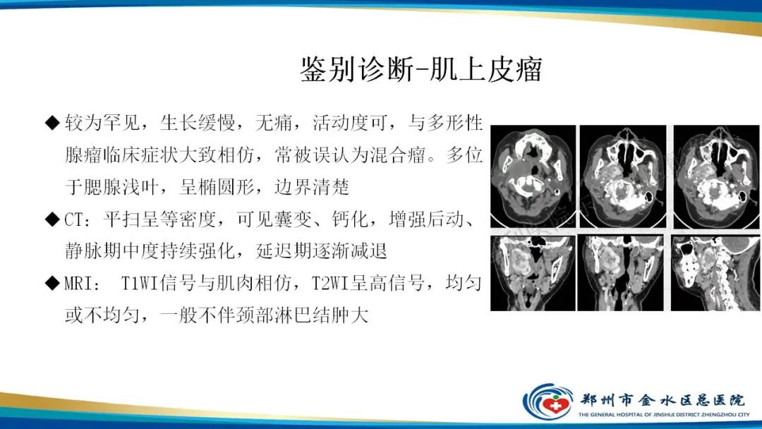 影像PPT - 【病例】腮腺多形性腺瘤1例CT影像-26