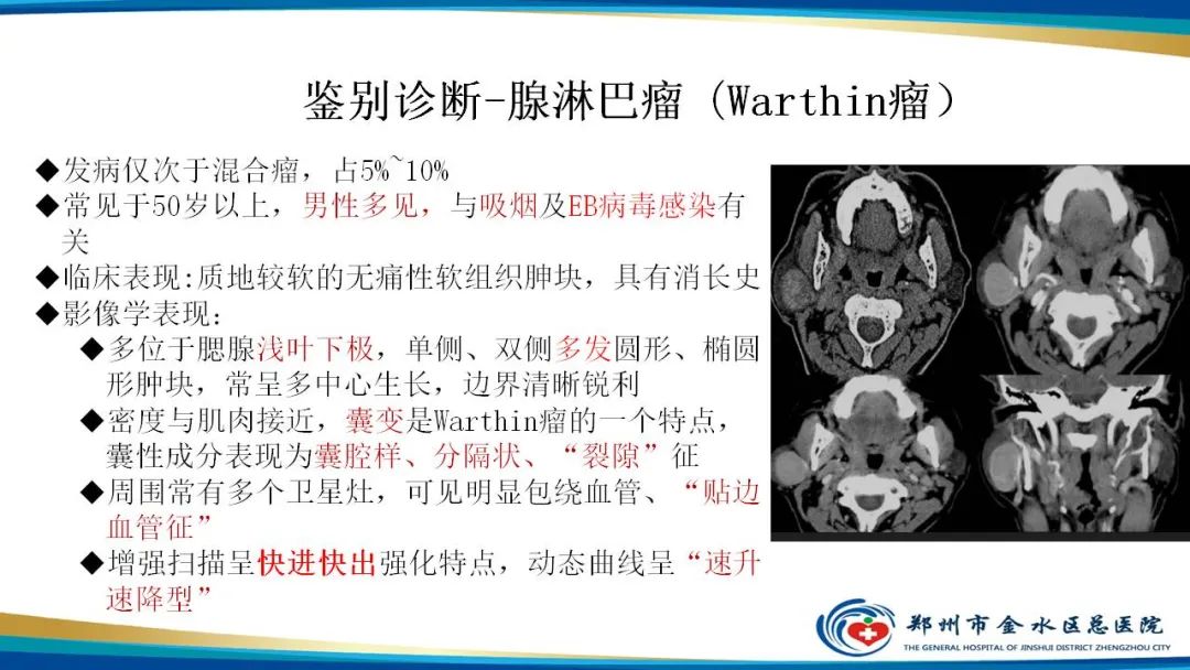 影像PPT - 【病例】腮腺多形性腺瘤1例CT影像-24