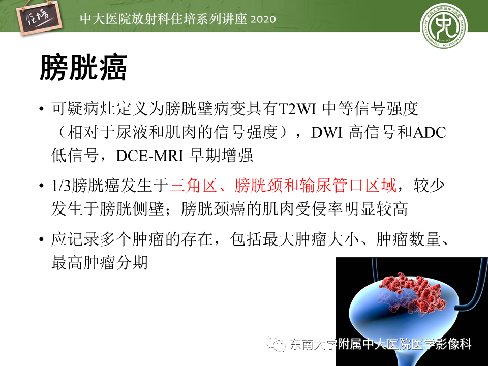 影像PPT - 【PPT】膀胱VI-RADS解读-12