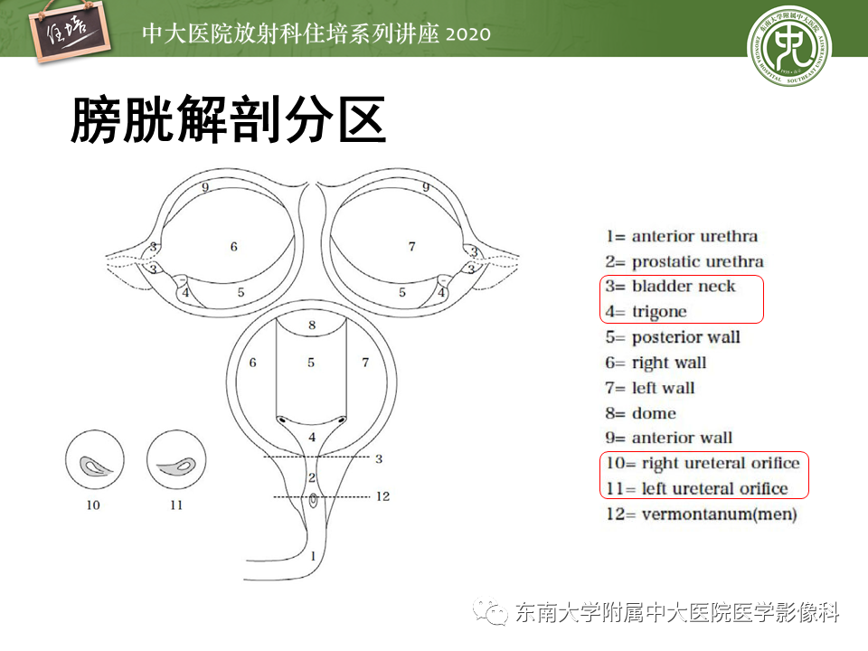 影像PPT - 【PPT】膀胱VI-RADS解读-13