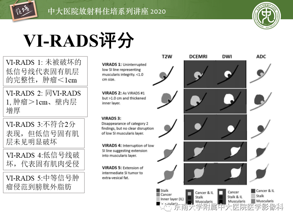 影像PPT - 【PPT】膀胱VI-RADS解读-20