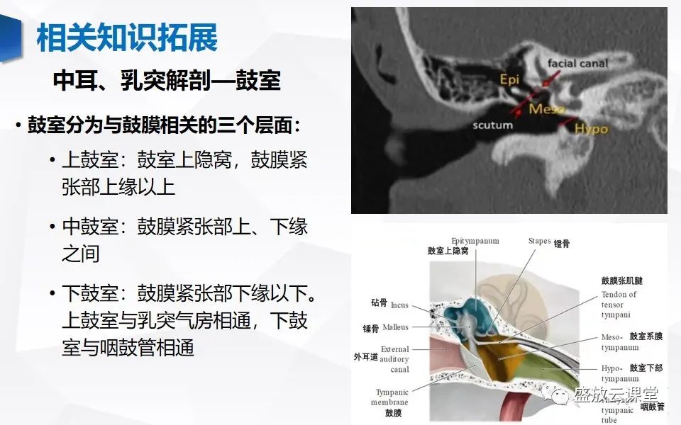 影像PPT - 【PPT】中耳乳突解剖及炎症-25