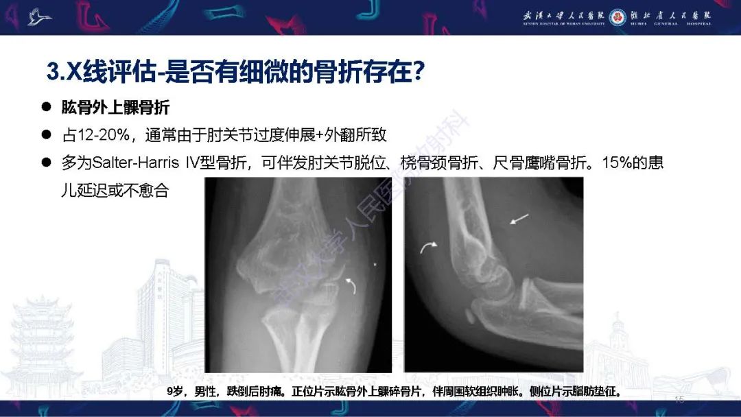 影像PPT - 【PPT】儿童肘关节外伤X线诊断-15