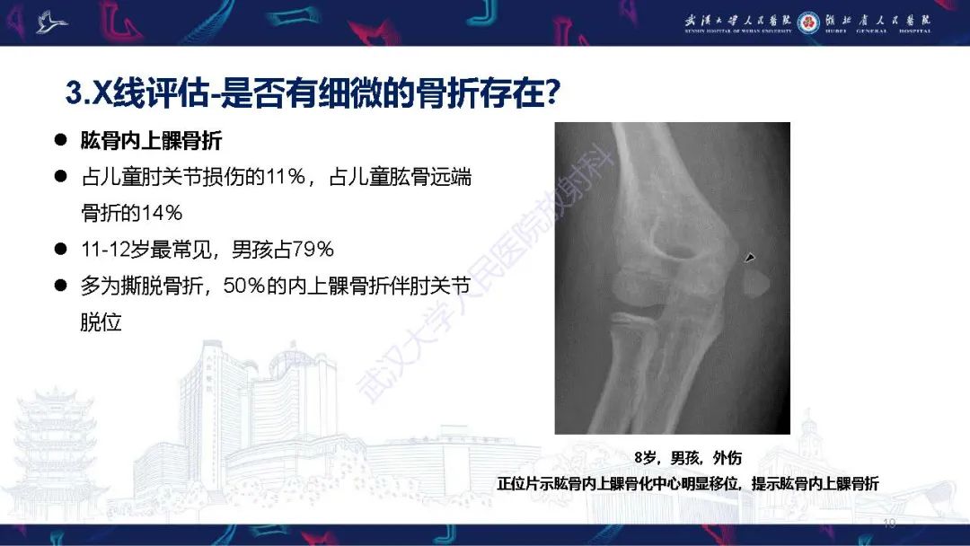 影像PPT - 【PPT】儿童肘关节外伤X线诊断-19
