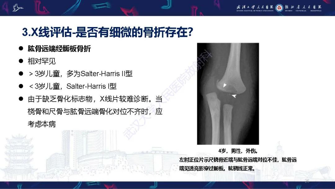 影像PPT - 【PPT】儿童肘关节外伤X线诊断-25