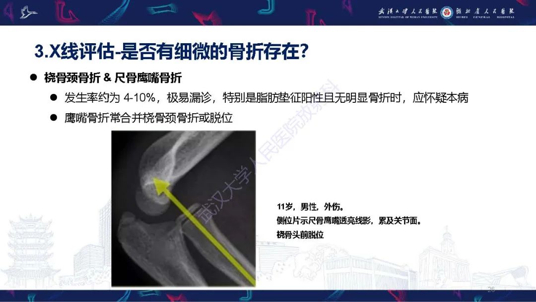 影像PPT - 【PPT】儿童肘关节外伤X线诊断-26