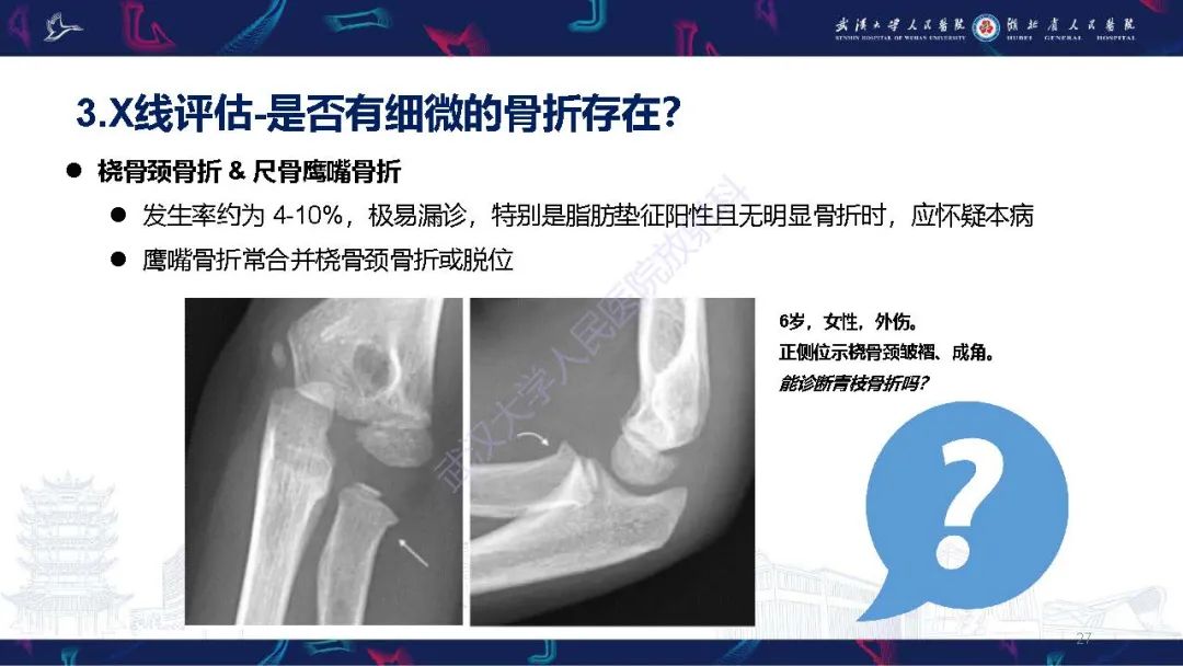 影像PPT - 【PPT】儿童肘关节外伤X线诊断-27