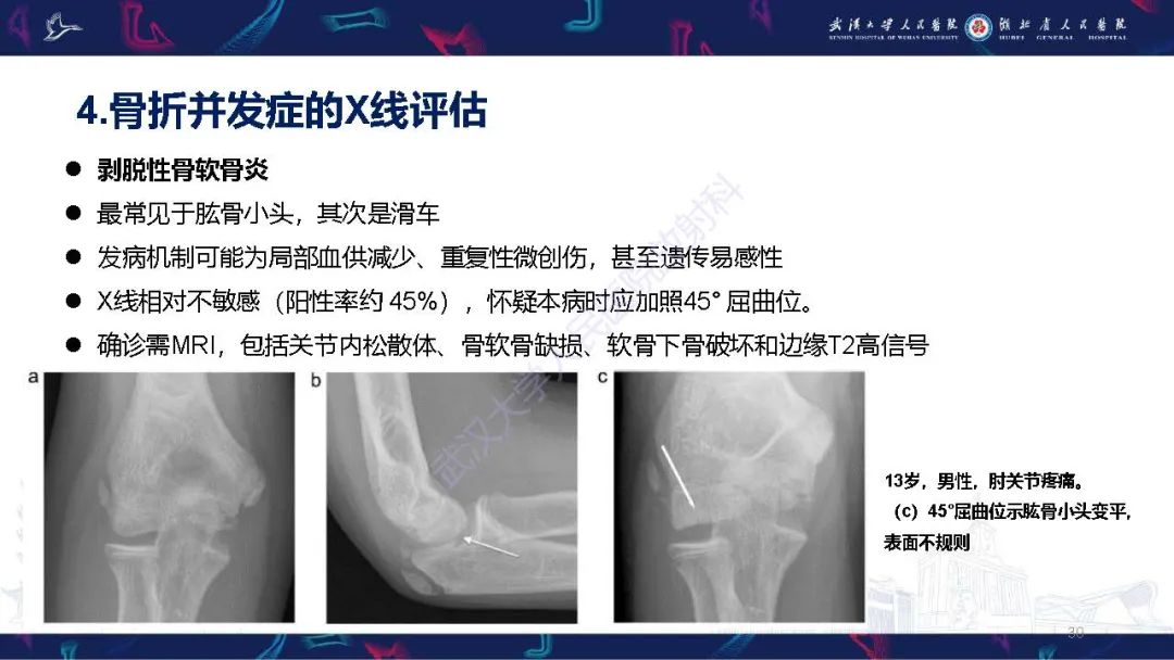 影像PPT - 【PPT】儿童肘关节外伤X线诊断-30