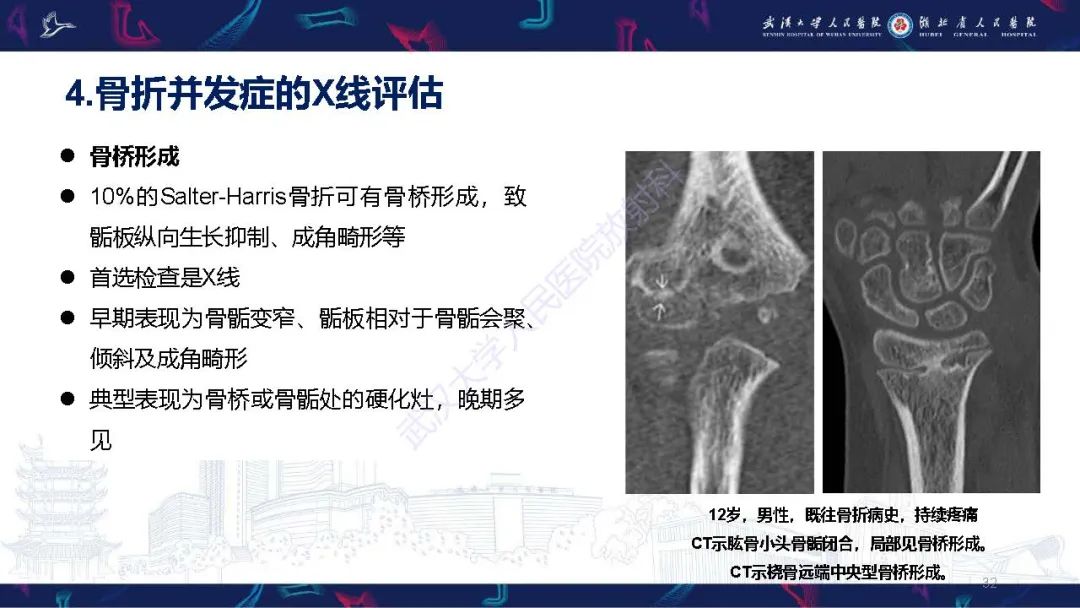 影像PPT - 【PPT】儿童肘关节外伤X线诊断-32