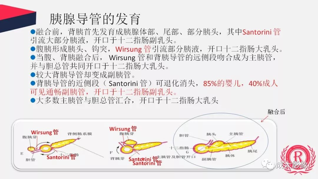 影像PPT - 【PPT】胰腺变异影像学诊断-4