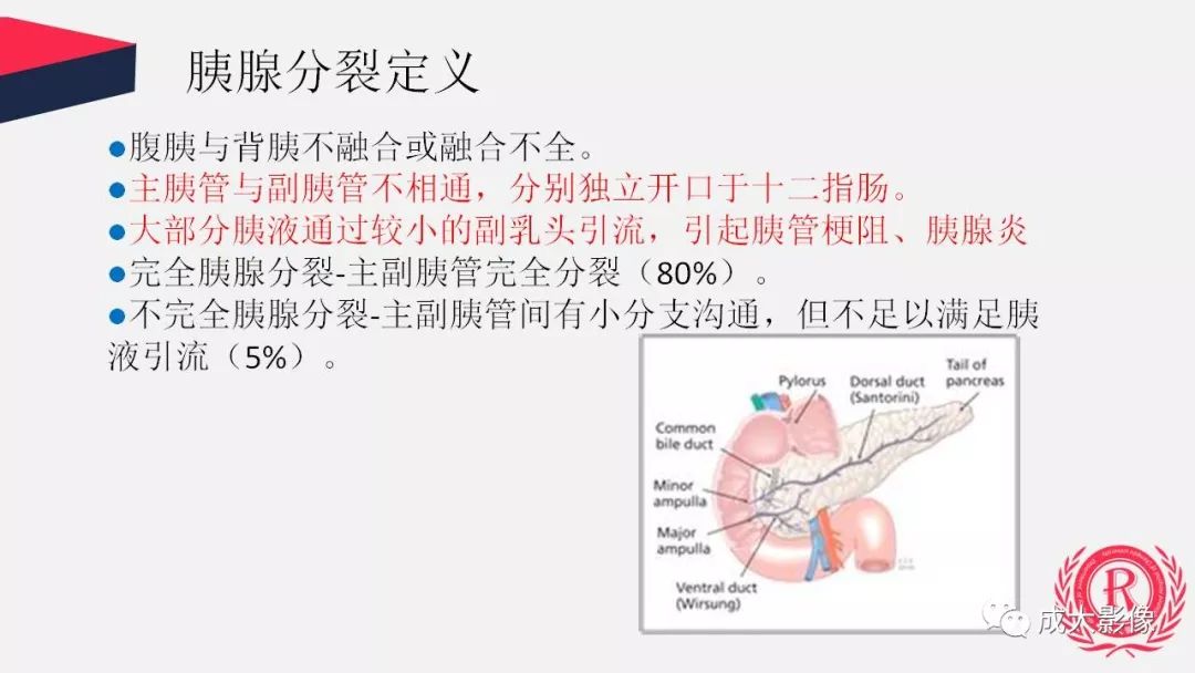 影像PPT - 【PPT】胰腺变异影像学诊断-7