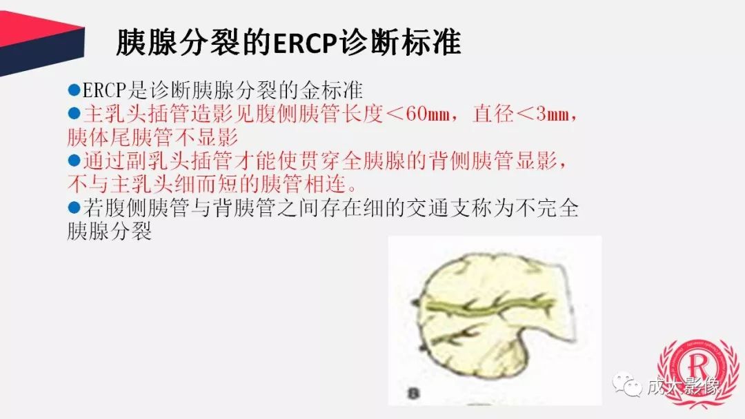 影像PPT - 【PPT】胰腺变异影像学诊断-10