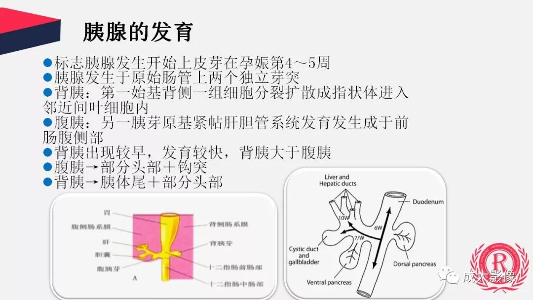 影像PPT - 【PPT】胰腺变异影像学诊断-3