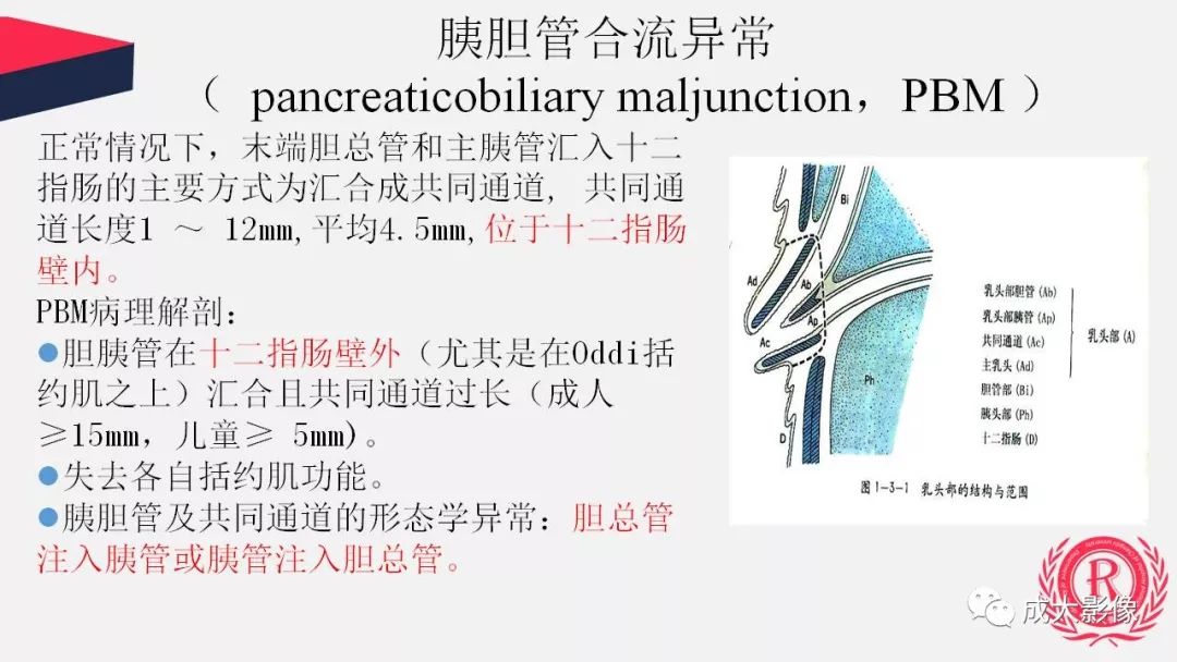 影像PPT - 【PPT】胰腺变异影像学诊断-20