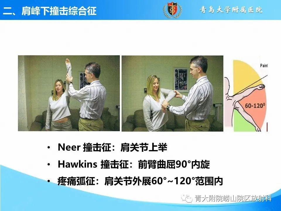 影像PPT - 【PPT】肩关节撞击综合征的影像评估-5