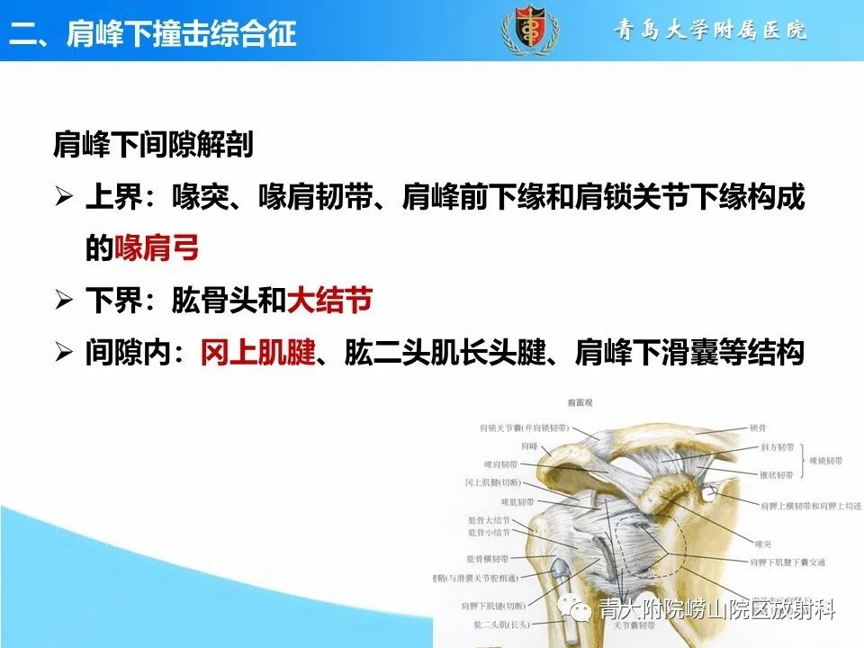 影像PPT - 【PPT】肩关节撞击综合征的影像评估-6