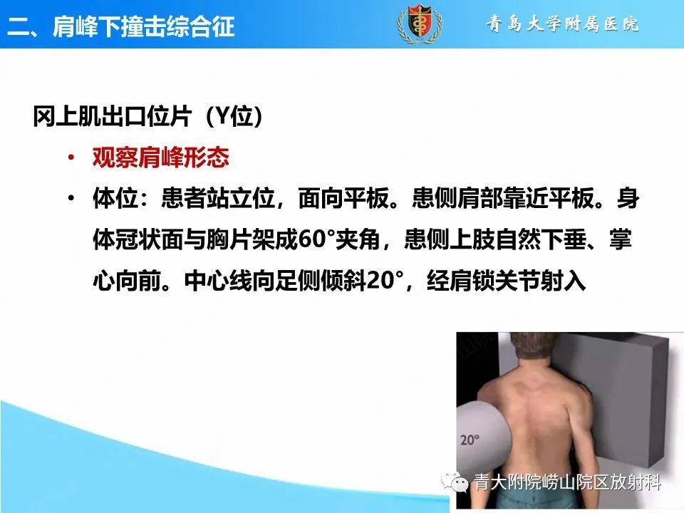影像PPT - 【PPT】肩关节撞击综合征的影像评估-13
