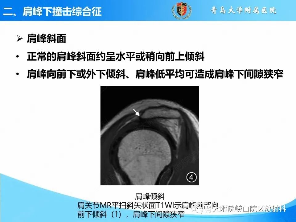 影像PPT - 【PPT】肩关节撞击综合征的影像评估-18