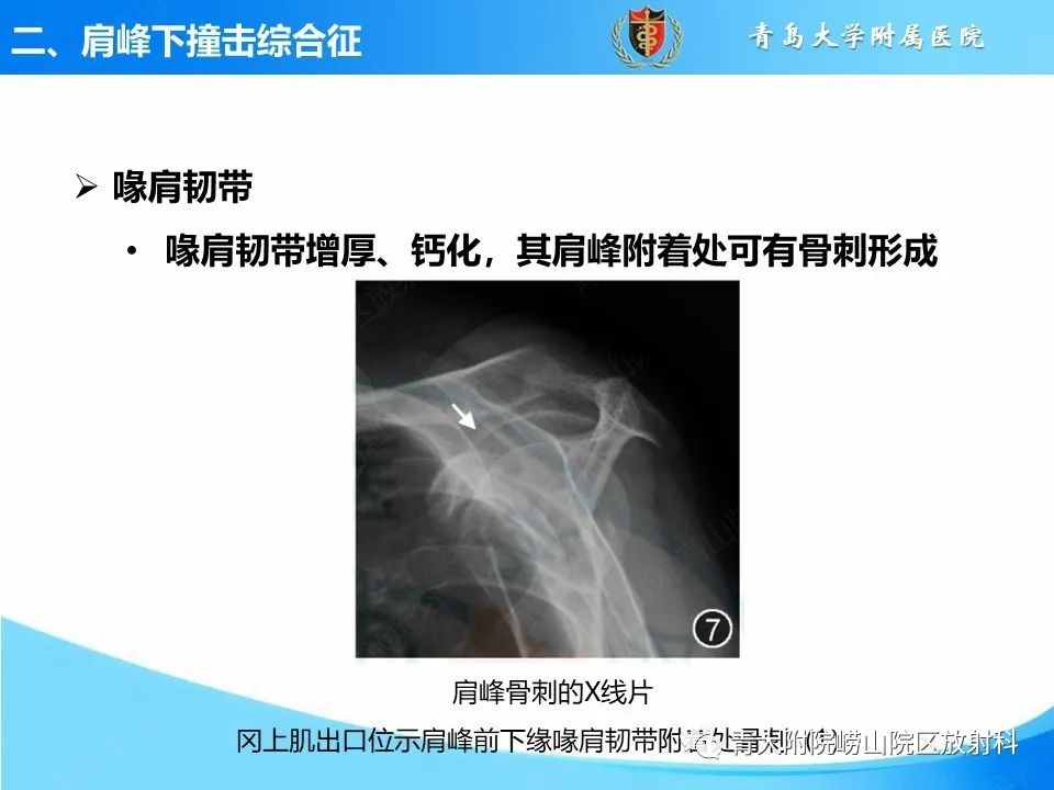 影像PPT - 【PPT】肩关节撞击综合征的影像评估-25