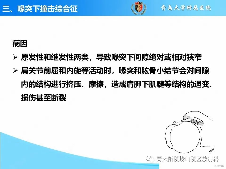 影像PPT - 【PPT】肩关节撞击综合征的影像评估-32