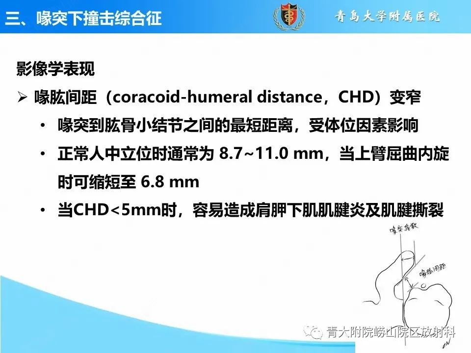 影像PPT - 【PPT】肩关节撞击综合征的影像评估-34