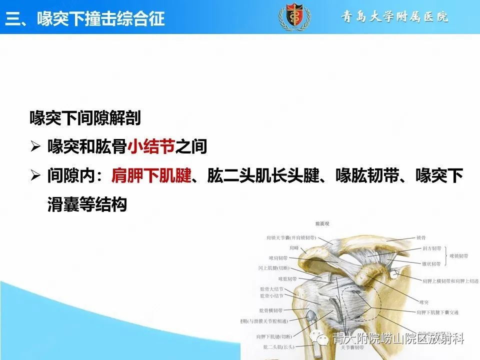 影像PPT - 【PPT】肩关节撞击综合征的影像评估-31