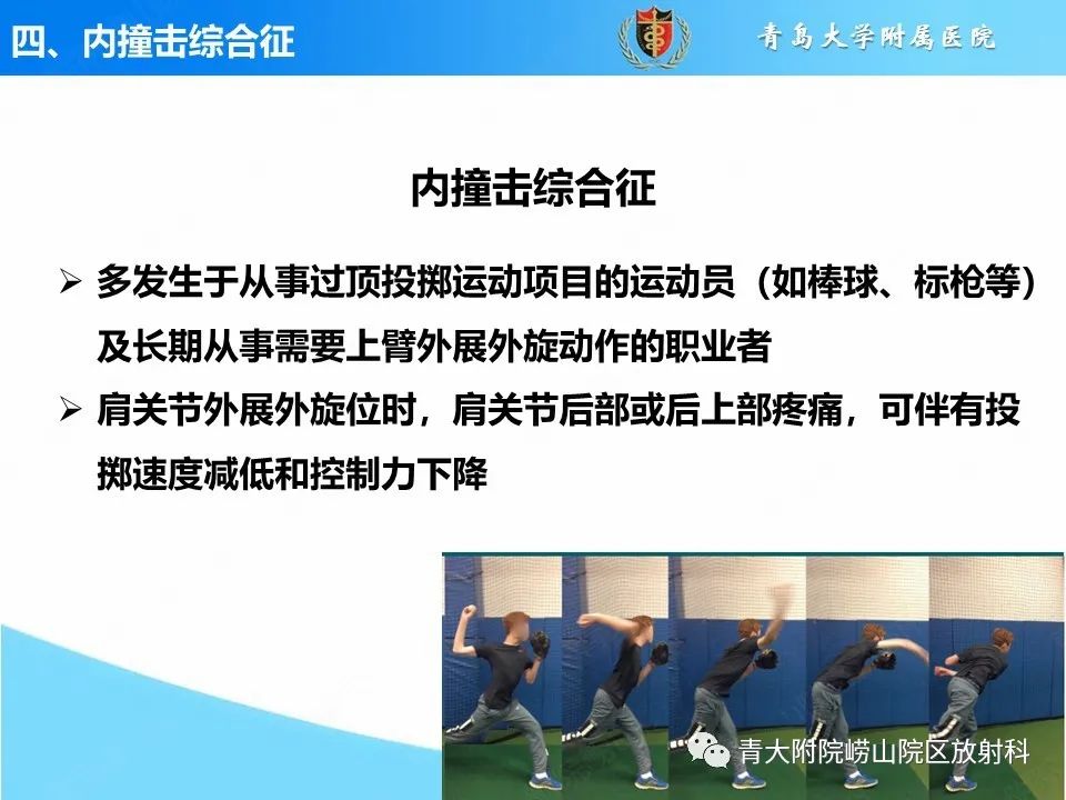 影像PPT - 【PPT】肩关节撞击综合征的影像评估-38