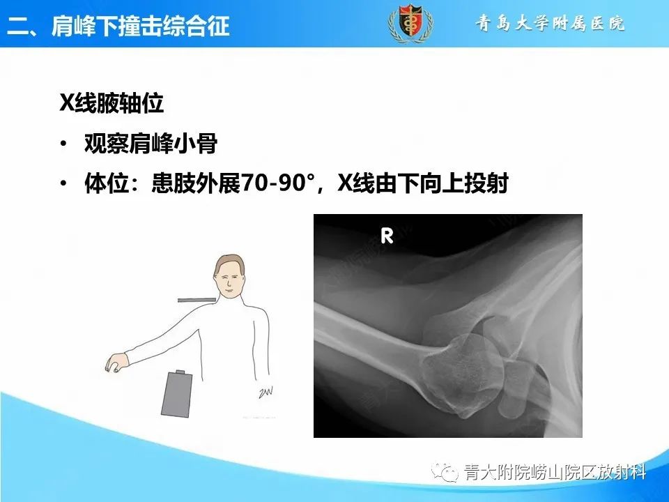 影像PPT - 【PPT】肩关节撞击综合征的影像评估-21