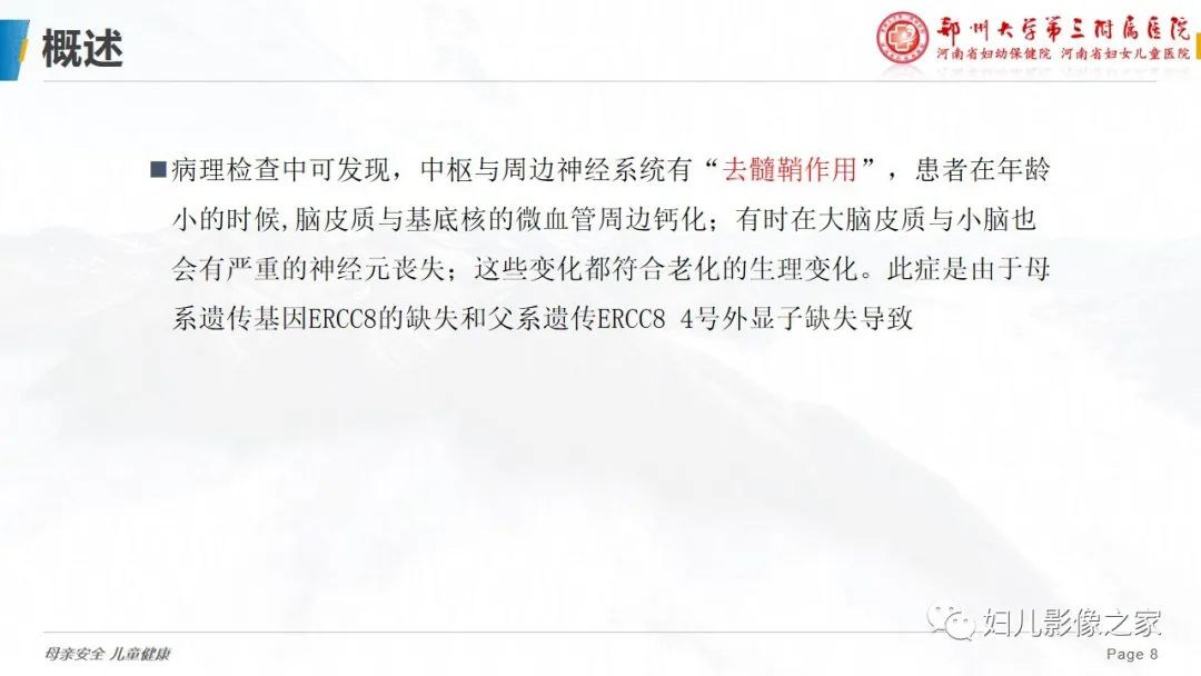 影像PPT - 【病例】cockayne综合征1例影像诊断-8