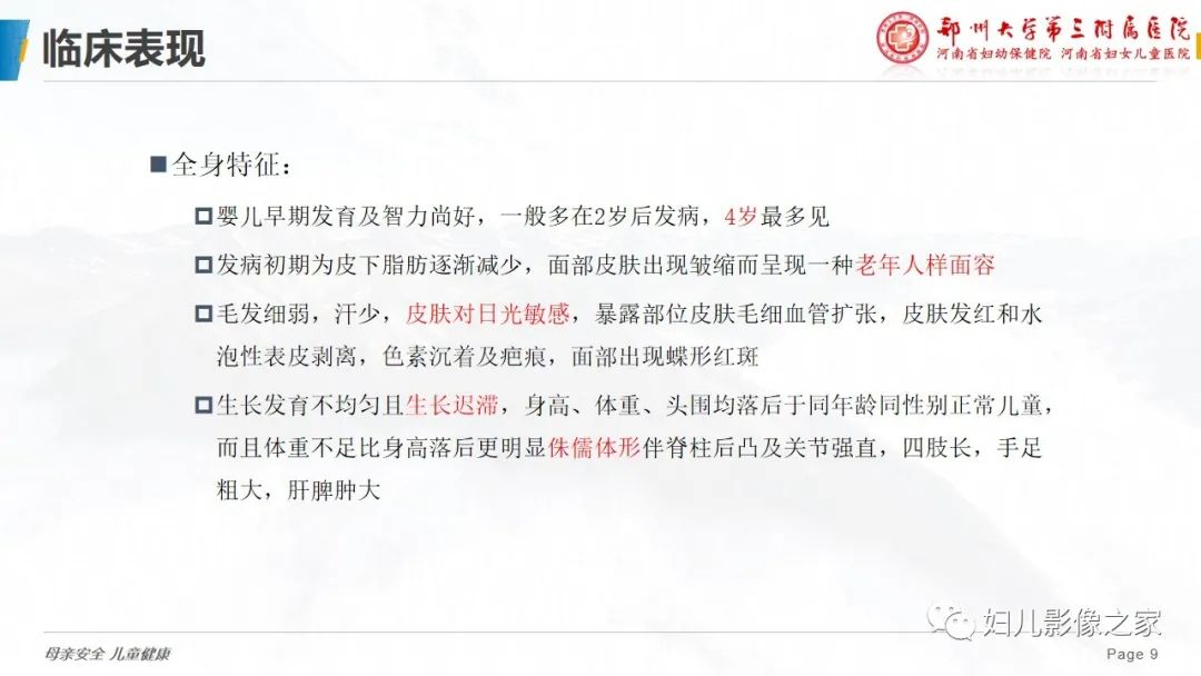 影像PPT - 【病例】cockayne综合征1例影像诊断-9