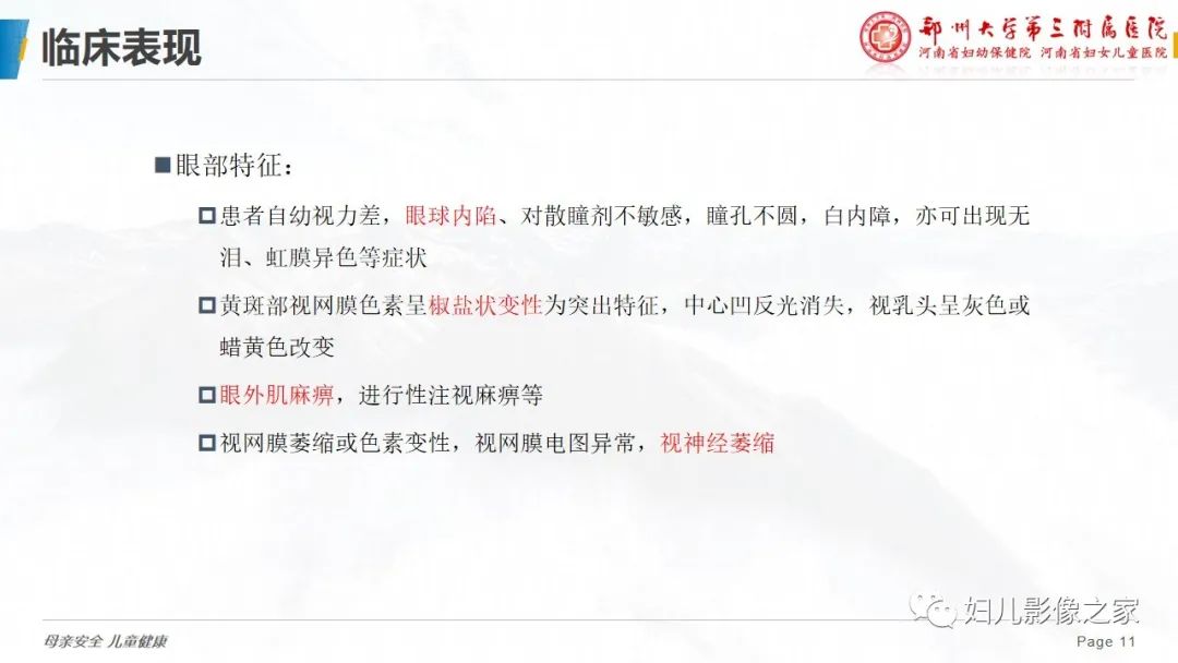 影像PPT - 【病例】cockayne综合征1例影像诊断-11