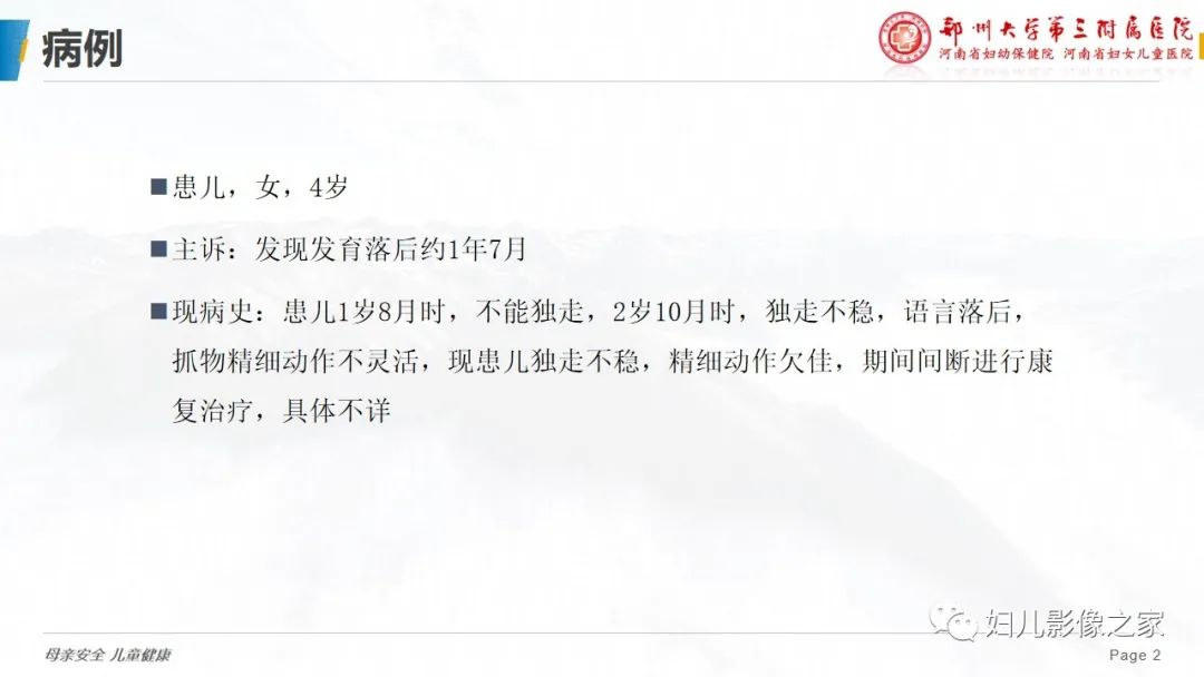 影像PPT - 【病例】cockayne综合征1例影像诊断-2